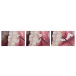 Calibra Veneer Try-In Accessory pack (5x1,8g)