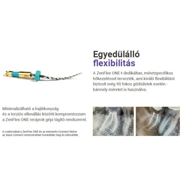 ZenFlex ONE file (3 db)