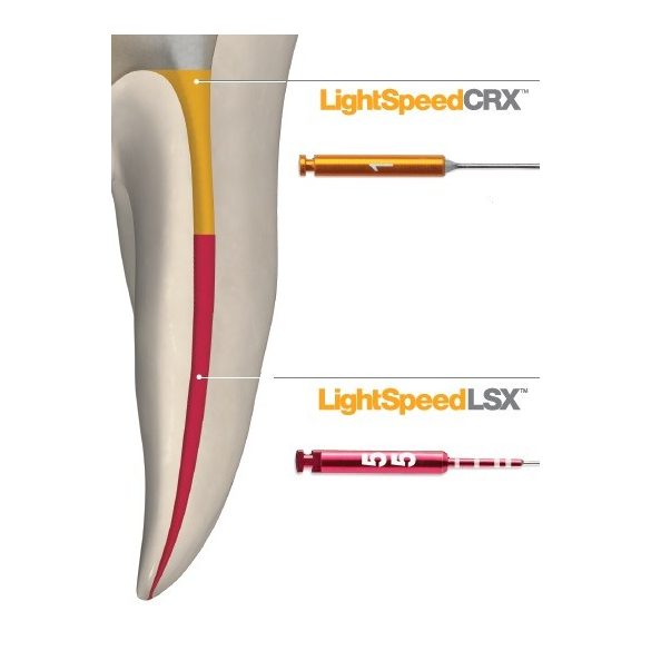 LightSpeed LSX  ISO 020-080 21-25mm (6db)