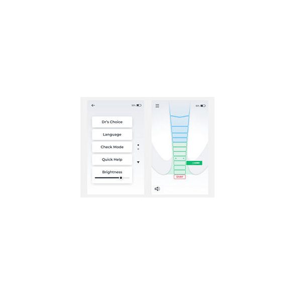 X-Smart Apex Locator