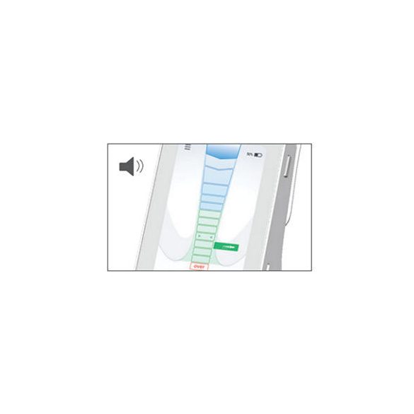 X-Smart Apex Locator