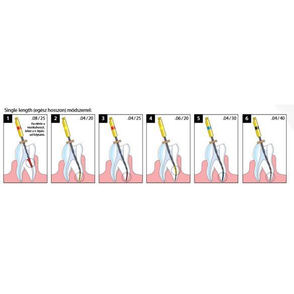 HyFlex CM NiTi File (6db)