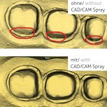 CAD/CAM Spray - 75 ml