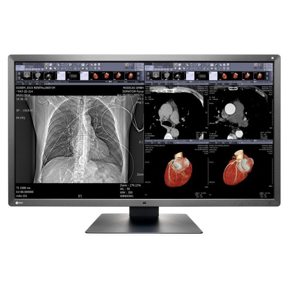 EIZO MX315W - 31", 8 Megapixel