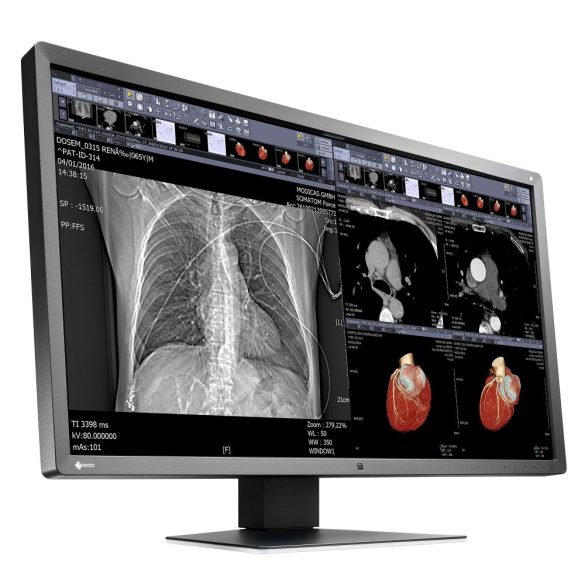 EIZO MX315W - 31", 8 Megapixel