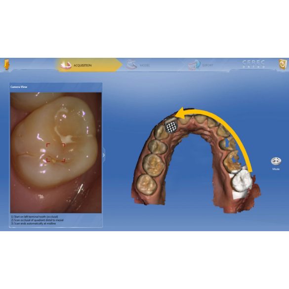 CEREC Omnicam