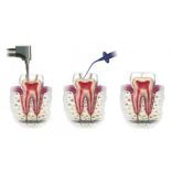 Calcipast Megapack 4x2,1g