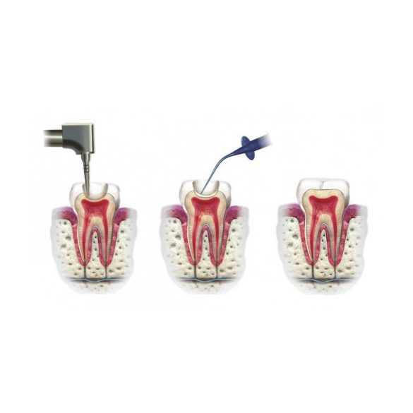 Calcipast Megapack 4x2,1g