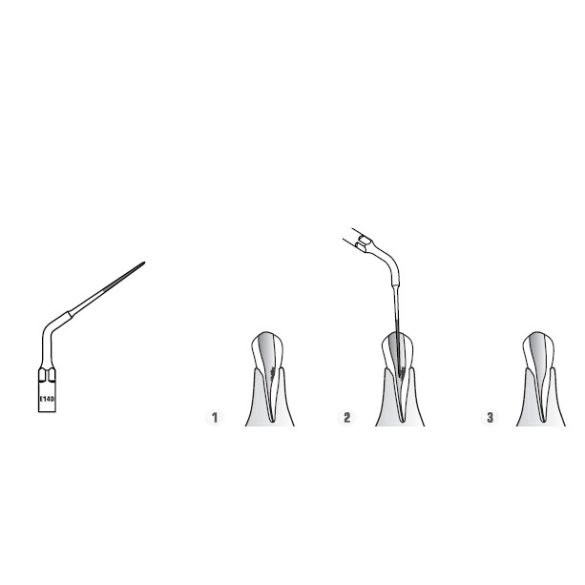 E14D Endodonciás depurátor hegy