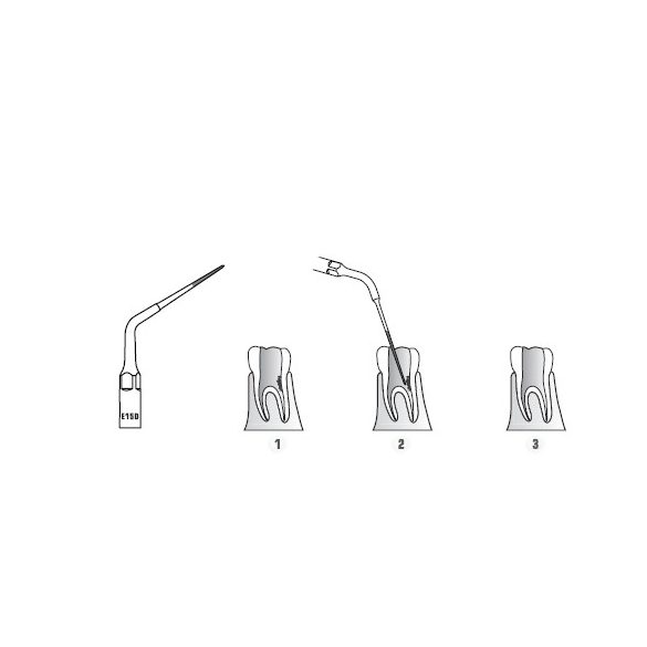 E15D Endodonciás depurátor hegy