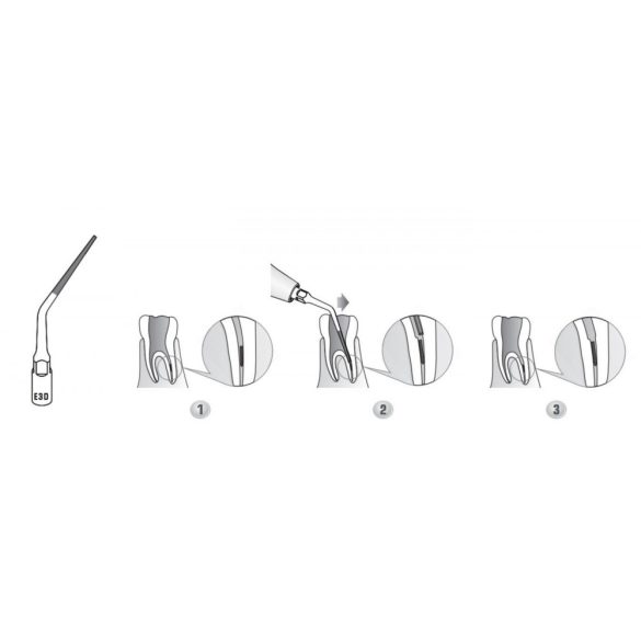 E3D Endodonciás depurátor hegy