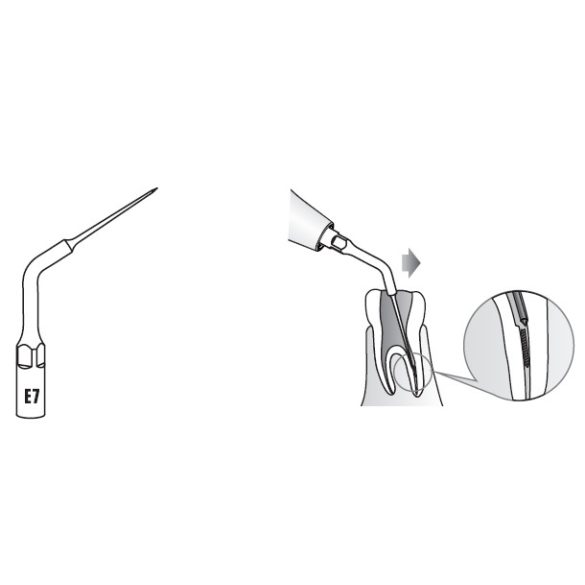 E7 Endodonciás depurátor hegy