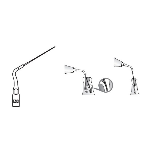 E93 Endodonciás depurátor hegy 