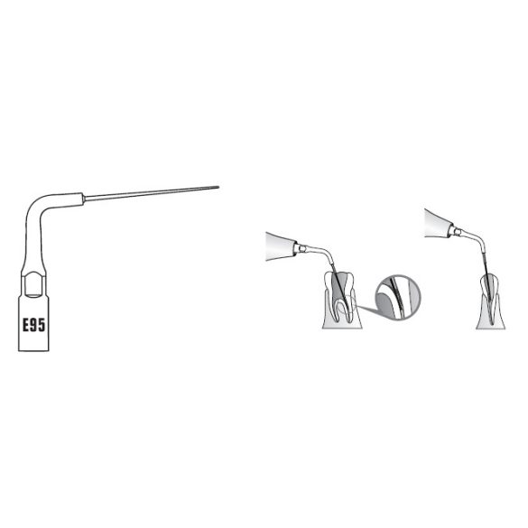 E95 Endodonciás depurátor hegy (EMS, Woodpecker, DG)