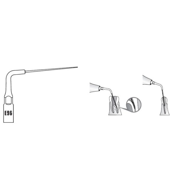 E96 Endodonciás depurátor hegy 