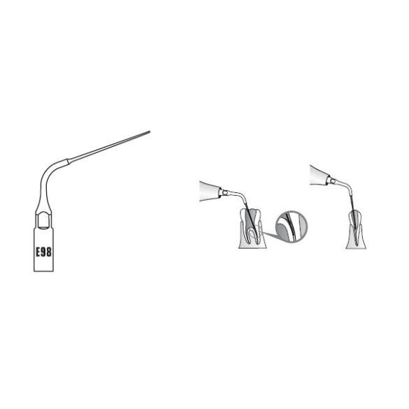 E98 Endodonciás depurátor hegy  