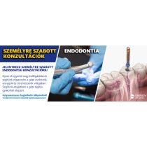Személyre szabott endodontiai konzultáció